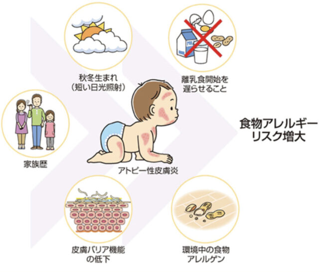 食物アレルギーリスクの図""