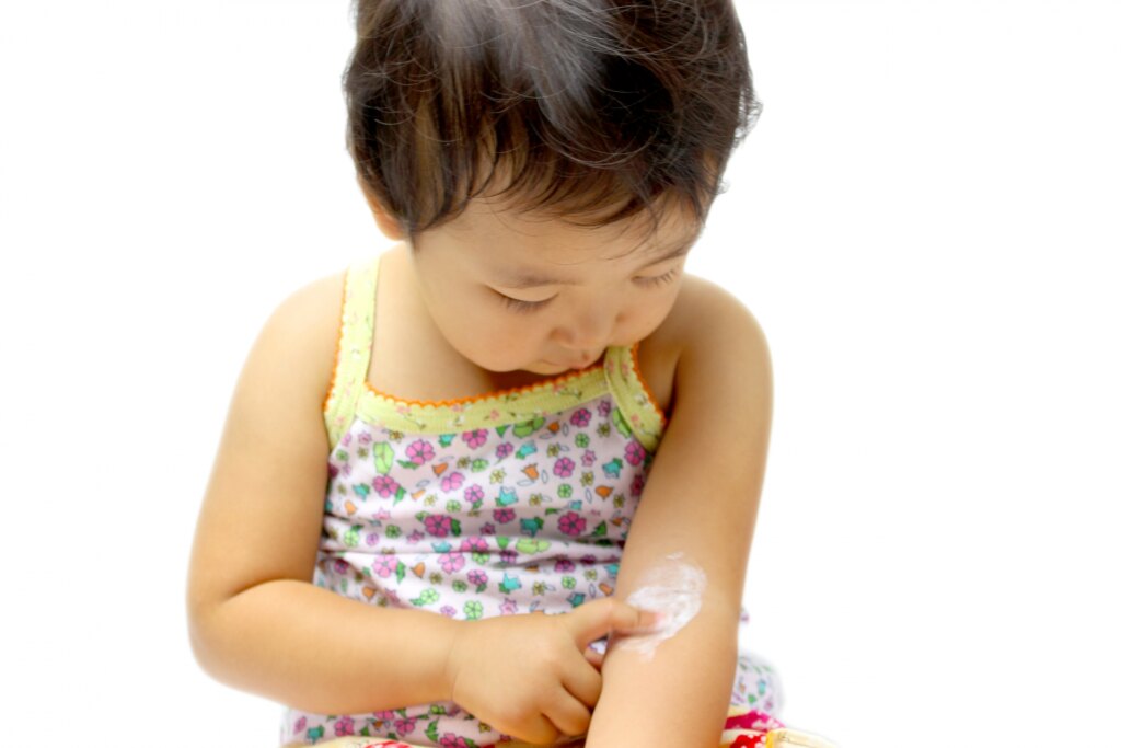 塗り薬を塗ってる子ども