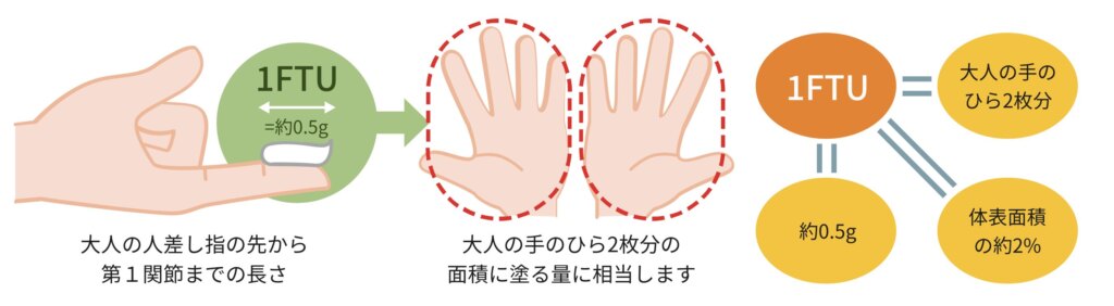 １FTUの説明